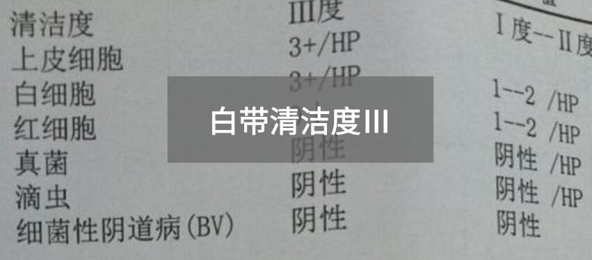 今天快讯！全自动白带樱花草在线社区www中文字幕生产厂家樱花草在线社区www中国中文为您官方解释白带清洁度3的意思