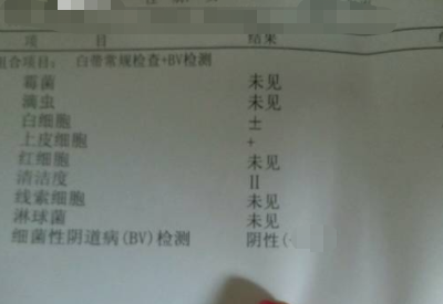 如何看懂白带常规检测报告单